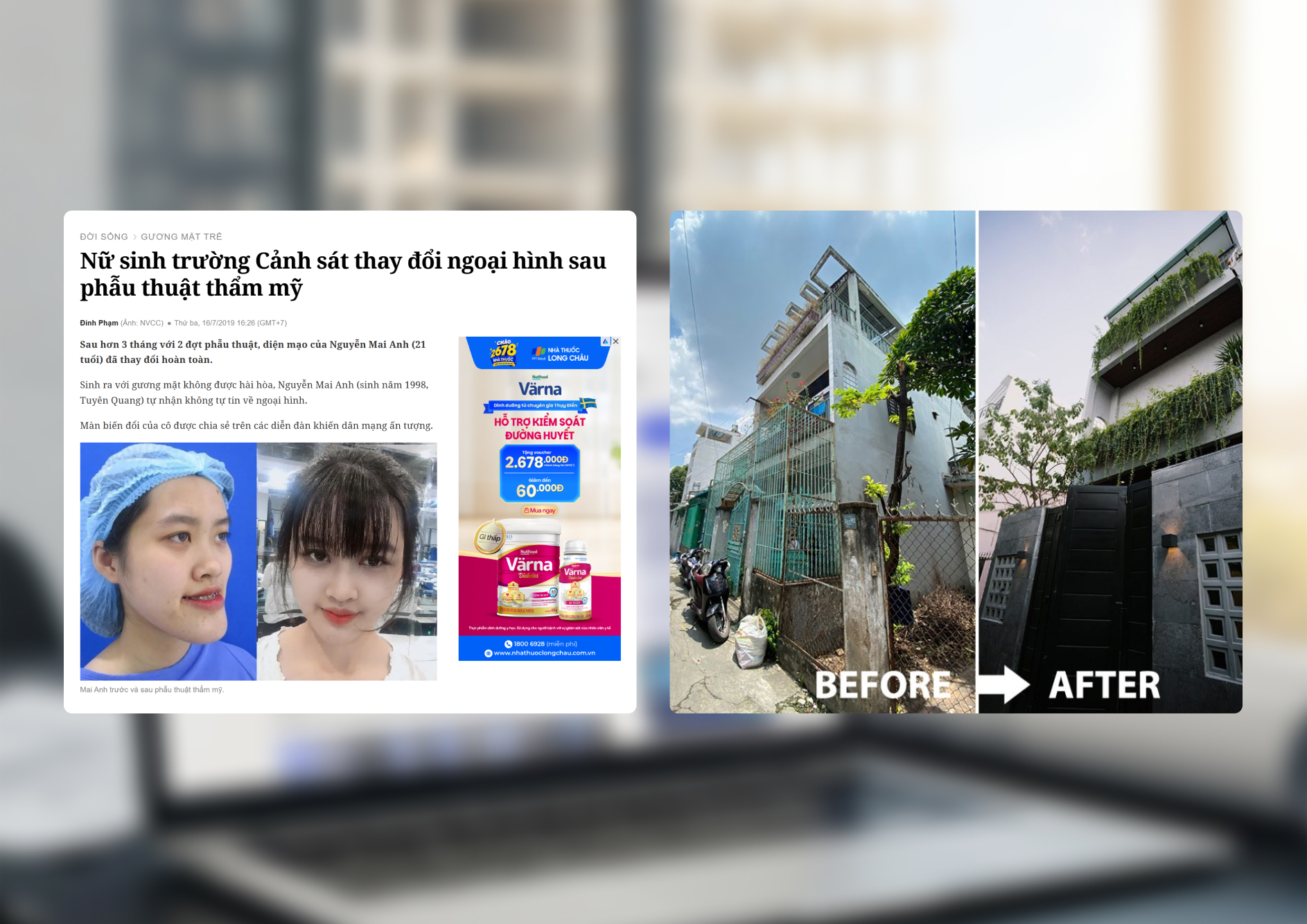 Bài Before – After: Định dạng PR so sánh trực quan