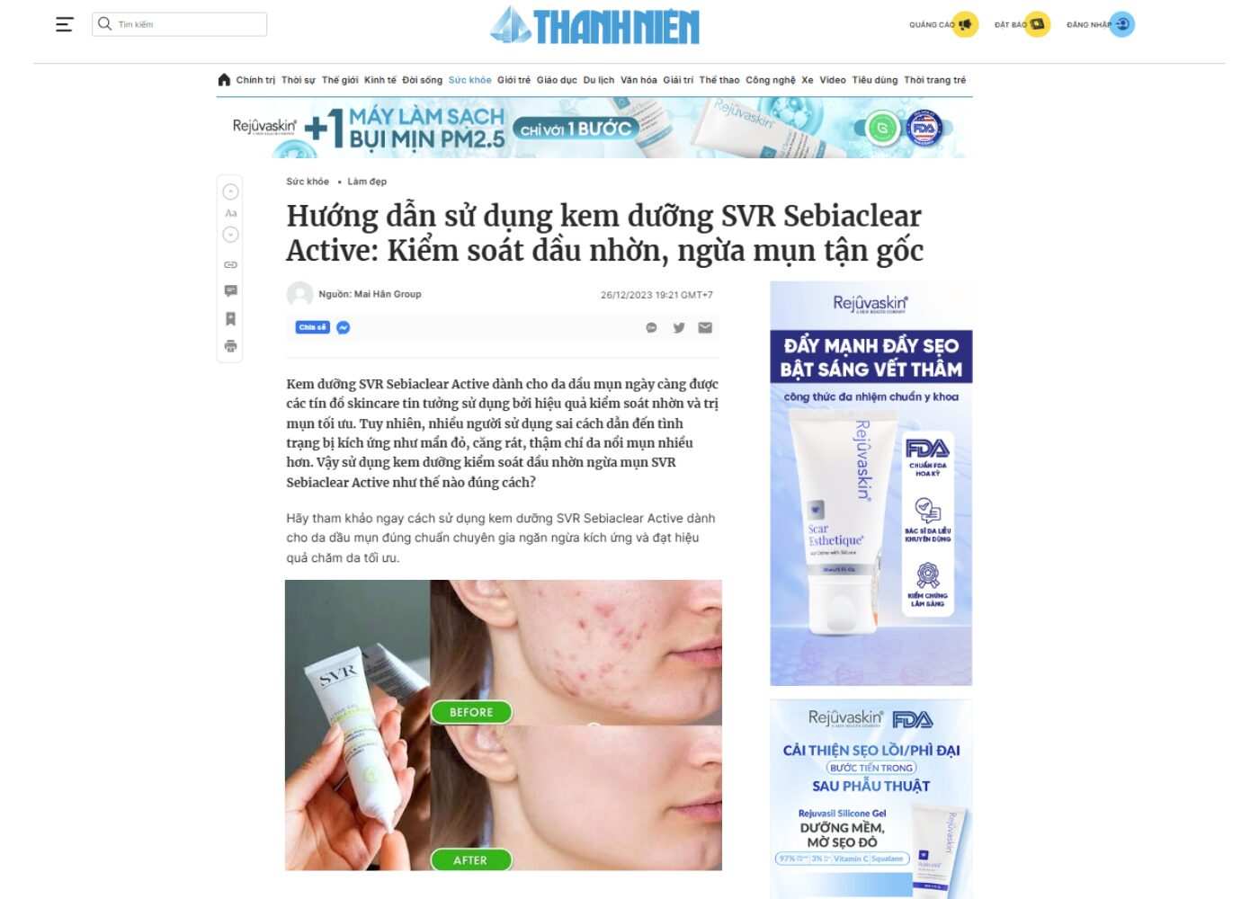 Bài Before – After phù hợp với nội dung nào?